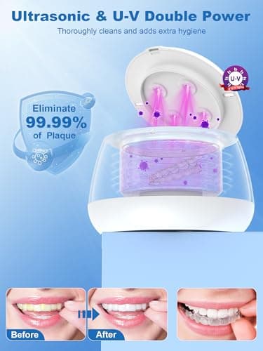KUNPHY Ultrasonic Retainer Cleaner Machine, 48kHz Dental Cleaning Pod for Braces, Night Guard, Mouthguard, Toothbrush, Denture, Jewelry White - Thumbnail 3