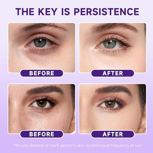 Sleeping EYES CREAM by PUQIANA - Infused with Acetyl Hexapeptide-8, Caffeine, Niacinamide & Hyaluronic Acid, Lifting, Hydrating, Wrinkle-Reducing & Soothing for Delicate Eye Area - Thumbnail 6