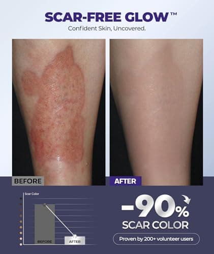 Silicone Scar Cream with 6.7% Active Ingredients, Scar Gel Visible in 2 Weeks, Moisturizing Scar Removal Clinically Show for Surgical, C-Section, Keloid, Acne & Burn Scars, Stretch Mark Cream(55ML) - Thumbnail 5