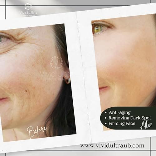 Vivid Ultra Vitamin C Serum for Face – Anti-Aging Serum with Hyaluronic Acid, Collagen & Vitamin E – Brightening Dark Spots, Firming Skin, Reducing Wrinkles & Acne Scars – 1 Fl Oz - Thumbnail 6