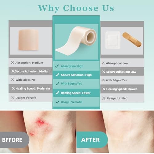 Medical Grade Hydrocolloid Bandages Roll, Hydrocolloid Pimple Patch Roll for Acne, Wound Care, Burns, Blisters, Bed Sore, First Aid Kit Essential, 0.3mm Thickness bandaids, 2in*16ft, Semi-Transparent - Thumbnail 3