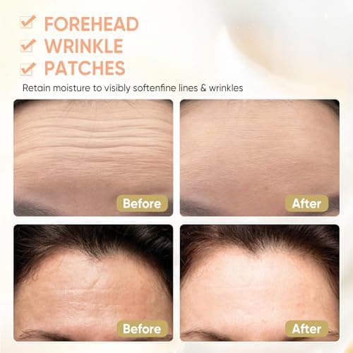 InfiniteRelax 12Pcs Forehead Wrinkle Patches for Women, Hydrolyzed | Collagen | Vitamin E | Aloe Vera to Reduce Wrinkles Forehead Wrinkles Treatment Overnight (Milky white) - Thumbnail 4