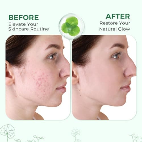 GNJOY Centella Serum, Face Hydrating Fermented Centella Asiatica Serum, Soothing, Barrier Repair, Firming, Revitalize Glowing Centella Ampoule Facial Moisturizer with Ceramide NP, for All Skin (50ml) - Thumbnail 5