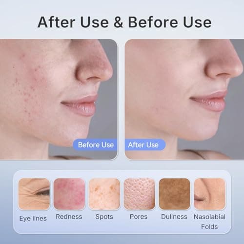 Hello Face Red Light Therapy Mask, 280 LEDs Quad-Chips Infrared Light Led Face Mask Light Therapy for Face Skin Care Improvement, Ultra-Soft Led Mask Light Therapy for 4 Modes with Eye Protection - Thumbnail 3
