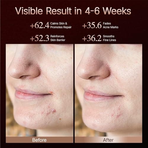 Hello Face 4D Red Light Therapy for Face, 311 LEDs Silicone Skin Improvement 850nm Infrared Led Face Mask Light Therapy for Photons Tech with Rechargeable Remote, ZERO-G Eye Chamber Design for Women - Thumbnail 5