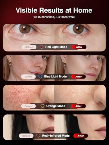 4D Wireless Red Light Therapy for Face, 328 LEDs 4 Modes LED Face Mask for Youthful Skin, 4000mAh 4Hours Rechargeable Smart Remote, Eye Protection, Skincare Wrinkles, Fine Lines, Dark Spots for Women - Thumbnail 4