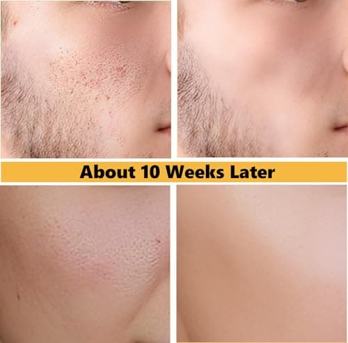 DEBAIY Moisturizer Cream Face Cream with 4% Niacinamide, 3% Tocopherol, Ceramides Boosts Skin Barrier for All Skin Types (3.53oz/100g) - Thumbnail 4