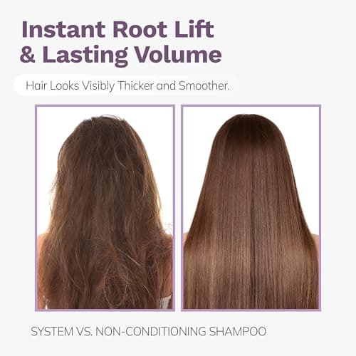 DORPANG Dandruff Shampoo for Oily Hair, Anti Dandruff and Oil Control Treatment Refresh Shampoo, Sulfate Free Daily Scalp Care, 355ml (12 fl oz) Floral Scent - Thumbnail 4