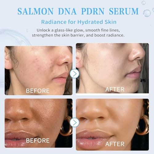 Salmon DNA PDRN Peptide Serum | 99% Salmon DNA PDRN Intensive Ampoule | Peptide, Collagen, 6 Hyaluronic Acid, Niacinamide | Anti-Aging, Moisturizing, Uneven Skin Tone, Korean Skincare 0.05 fl oz x 30e - Thumbnail 2