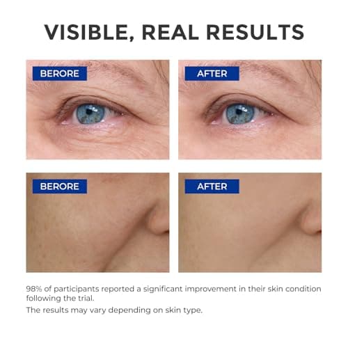 SKINERSE Retinol Serum for Face, Anti Aging Serum, Retinoid Collagen with Vitamin E Resurfacing Facial Rapid Fine Lines Repair, Brightening Pore Minimizer for Face Daily Skin Care Treatment 1oz - Thumbnail 3