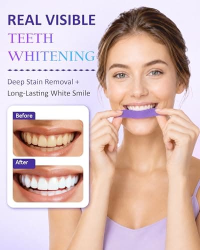 Teeth Whitening Strips, Purple Whitening Strips, Purple Color-Correcting Technology, Deep Stains Removal, Enamel Safe & Low-Sensitivity, Mint Flavor for a Brighter Smile, 28 Strips (14 Treatments) - Thumbnail 4