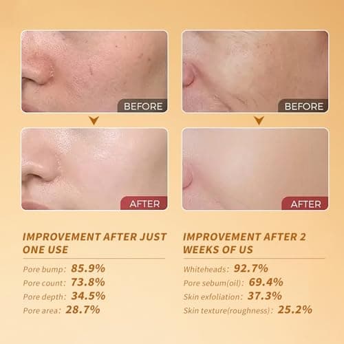 Black and White Rice Peeling, Soft Rice Exfoliating Face and Body, New glow rice Black and White Rice Exfoliant Duo Ampoule Set for All Skin Types, Gentle Peel & Deep Hydration 2 Pack (2.7 fl oz Each) - Thumbnail 6