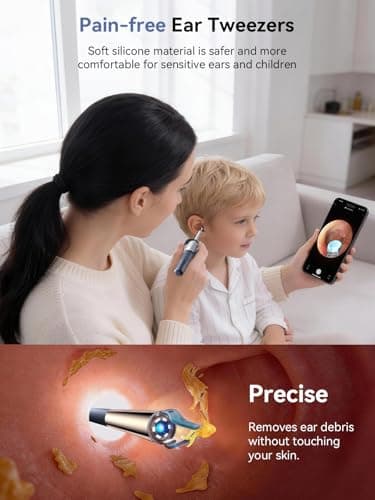 Ear Wax Removal Tool Camera: ZERONDER I35R Ear Cleaner with Flexible Ear Camera Otoscope - Visual Ear Pick Tweezers Wax Remover - Ear Cleaning Kit for Family - Thumbnail 3