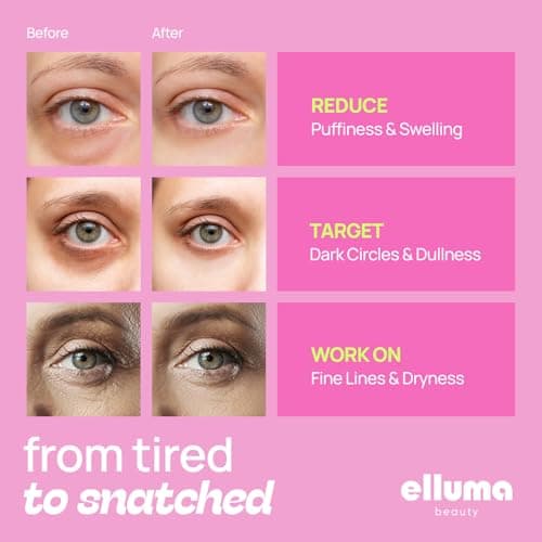 Elluma Beauty Under Eye Patches | Eye Mask for Puffy Eyes & Dark Circles, Hydrogel Eye Gel Pads with Menthol & Taurine, 12 Pairs - Thumbnail 2