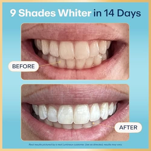 Lumineux Teeth Whitening Strips - 21 Treatments (3 Months) - Peroxide Free - Enamel Safe for Whiter Teeth - Whitening Without The Sensitivity - Dentist Formulated - Sensitivity - Thumbnail 2