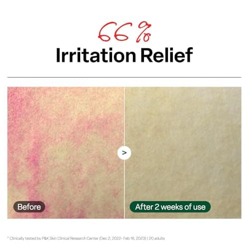 Dr. G R.E.D. Blemish Clear Soothing Toner - Korean Soothing Toner for Glowing Skin - Soothes Irritation Clear Skin - Mild Exfoliant - with AHA, BHA & Centella Asiatica - 10.14 fl oz - Thumbnail 4