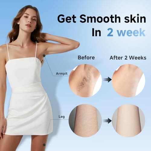 Painless IPL Laser Hair Removal for Women & Men, 39°F Sapphire Ice Cooling Technology, At-Home Laser Hair Removal Device for Face, Armpits, Legs, Bikini & Whole Body, Long-Lasting Results - Thumbnail 6