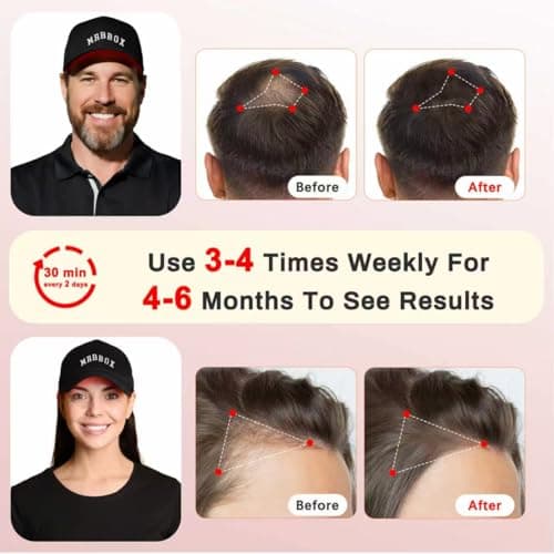 Laser Hair Growth Cap, Irradiation Aesthetic Device - Thumbnail 5