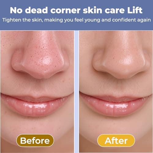 Blackhead Remover Tool for Nose Pore,Dual-Head Face Scraper & Pore Cleaner for Deep Facial Cleansing, U Shaped & Circular Widened Head Skin Care Tool for Men and Women (White) - Thumbnail 3
