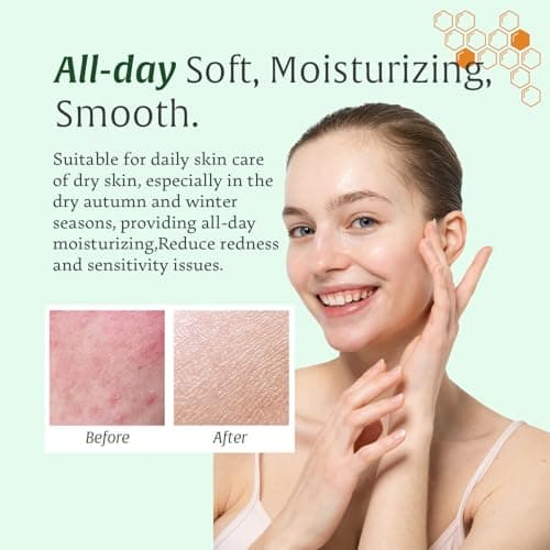 Whipped Honey Tallow Balm for Skin – 100% Grass-Fed beef Tallow, Manuka Honey, Body Butter, Dry Skin Cream, Natural Moisturizing Cream for Dry, Sensitive Skin, Eczema & Body Care, 4 oz - Thumbnail 2