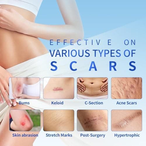 Safirst Silicone Scar Sheets 1.6"x59" Roll-1.5M Scars Removal Treatment Medical Grade Silicone Scar Tape for Skin Resuable Strip for Tummy Tuck,Incision,Keloid,C-Section,Burn,Acne Scars - Thumbnail 3