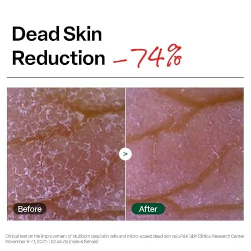 Dr. G Brightening Peeling Gel - Korean Skincare for Glowy Skin - Aqua Gommage Facial Exfoliator - Hyaluronic Acid, Ceramides, Vitamin C - Smooth Skin Texture, Low Irritation - Bulk Items - 4.23 fl oz - Thumbnail 4