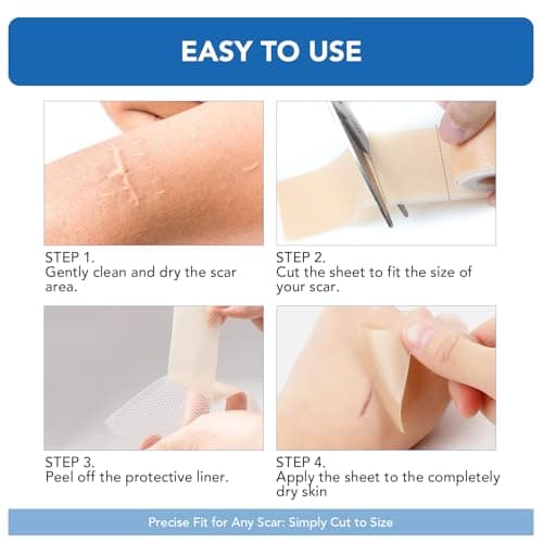 Silicone Scar Sheets, Silicone Scar Tape(1.6"x 200" Roll-5M) - Reusable, Soft & Medical Grade Adhesive Tape for Old & New Scars, C-Section, Surgery, Keloid & Acne Scars - Thumbnail 4