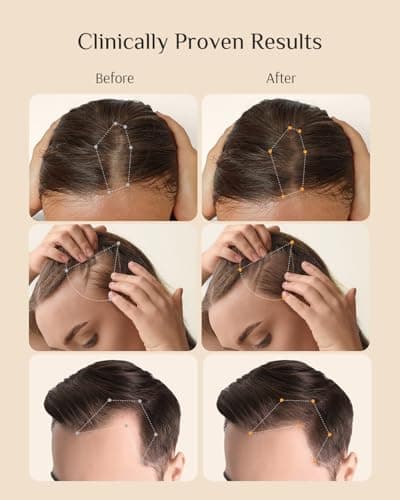 DR ZERO REDENICAL Hair Growth Shampoo for Women | MONDE SELECTION Gold Winner | Swiss Patent Redensyl | Clinically Proven Anti-Thinning | Japanese-Made Volumizing & Repair Shampoo, Gifts for Women - Thumbnail 3