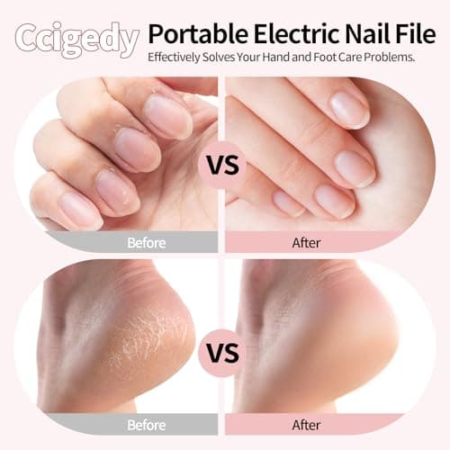 Electric Nail Drill Kit, Nail Filer Electric with LCD & Lamp, Rechargeable Pedicure Tools for Feet, Toenail Grinder for Thick Toenails, Cordless Nail Dremel Tools for Women & Men - Thumbnail 2