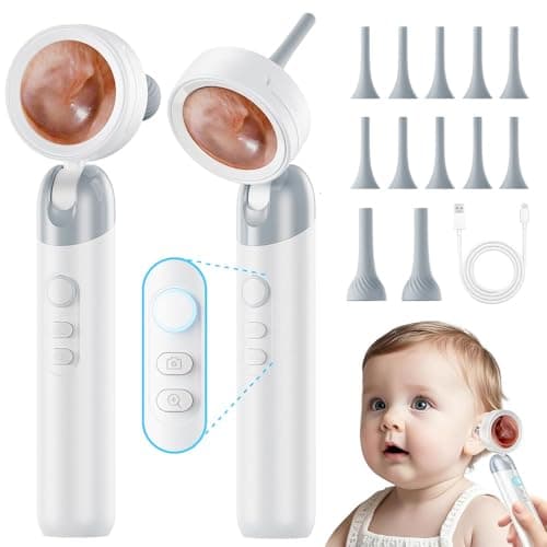 Aspoven Otoscope Ear Camera with Light, 1.4” Screen 1080P HD Ear Scope, 12 Silicone Specula Tips, Photo & Video Recording, Type-C Rechargeable, Ear Cleaning Camera for Adult Kid and Pet