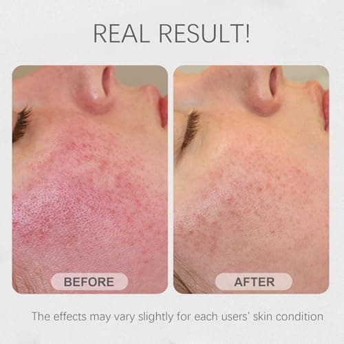 Bmrewax Rice Face Mask, Gentle Exfoliating Wash Off Facial Mask for Dull, Rough Skin, Pore Clearing, Remove Dead Skin Cells for All Skin Types 3.53 Fl Oz - Thumbnail 6