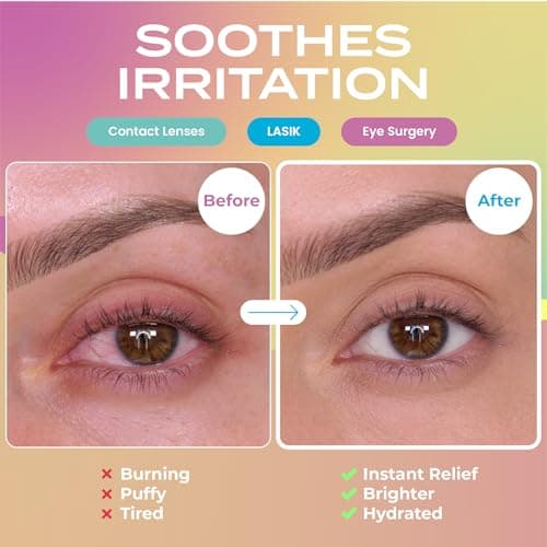 Body Restore Heated Eye Mask for Dry Eyes 5 Pack – Mothers Day Gifts for Mom, Self Heating Warm Compress, Birthday Gifts for Women, Relaxation – Variety - Thumbnail 3