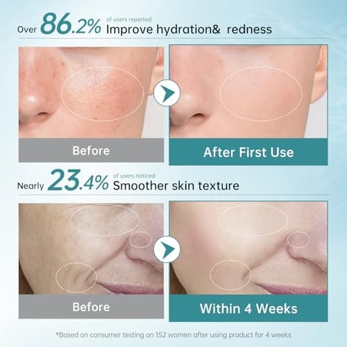 BOLI PDRN Serum, Salmon Peptide Niacinamide Serum Hydrating, Moisturizing, Uneven Skin Tone Essence (0.05 fl.oz x 30pcs) - Thumbnail 5