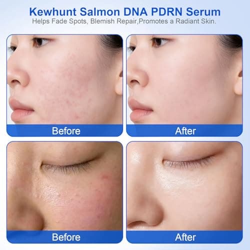 Salmon DNA PDRN Anti-Aging Facial Serum, 10,000ppm Salmon Egg DNA Ampoule, 3000ppm Collagen, Peptide, Glutathione, Niacinamide -Wrinkles, Firming, Radiance Skincare, 0.05 fl.oz x 30e - Thumbnail 4