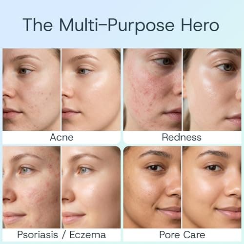 Hypochlorous Acid Spray for Face & Skin - Clinically & Dermatologist Tested HOCl Face Mist for Face, Skin, Acne, Eczema, Rash & Wound Care, Gentle & Non-Irritating for All Skin Types & Ages, 4oz - Thumbnail 2