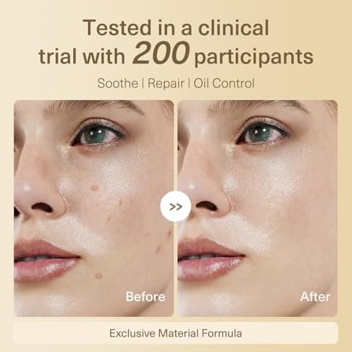 BHMNDSKY Acne Repair Mask,Deep Clean Pores,Oil Control, Overnight Face Mask Glow Skin- Elasticity, Repair,Hydrating, Firming and Moisturizing Skincare, 28g, 5ea - Thumbnail 5