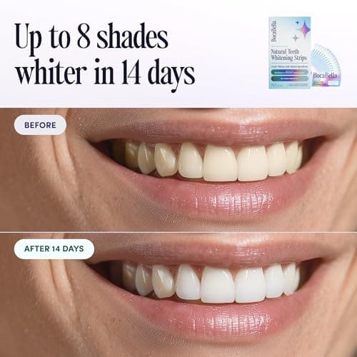 Teeth Whitening Strips for Sensitive Teeth – Natural, Peroxide-Free & Enamel-Safe | Clinically Tested Papaya & Pineapple Enzymes + Aloe & Coconut Oil | 14 Treatments for a Brighter, Whiter Smile - Thumbnail 4