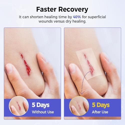 GIATATHA Hydrocolloid Roll for Acne, Blister, Wound, Pimple Patches for Face Hydrocolloid Bandages Cut to Size, Flexible & Waterproof, Ultra Absorbent, First Aid Supplies, Medical Supplies(2in*16ft) - Thumbnail 3