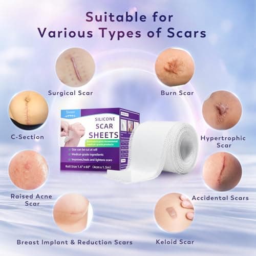 Yarster Silicone Scar Sheets, Silicone Scar Tape(1.6"x 120" Roll-3M), Medical Grade Scar Sheets, Scar Tape for Surgical Scars, Burn, C-Section, Keloid Scars, Acne Treatment, Stretch Marks Removal - Thumbnail 3