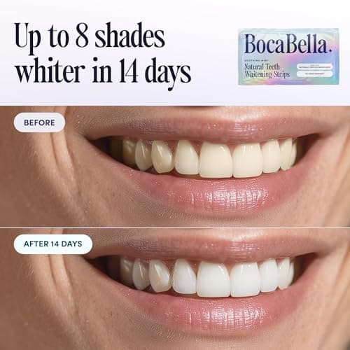 Natural Teeth Whitening Strips – Peroxide-Free, Enamel-Safe & Sensitivity-Free | 7 Treatments | Papaya & Pineapple Enzymes + Coconut Oil | Gentle Daily Stain Removal for a Brighter, Whiter Smile - Thumbnail 4