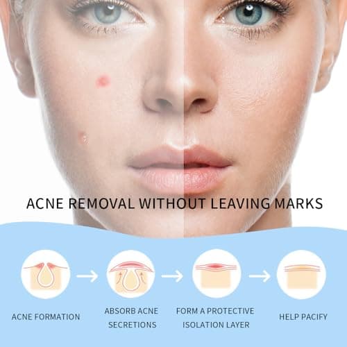 Safirst Star Acne Patches Hydrocolloid Pimple Absorbing Patch 3 Sizes 200 Counts Spot Blemish Stickers Zit Dot Colorful Cover Breakout Hiding Face Emergency Treatment - Thumbnail 6