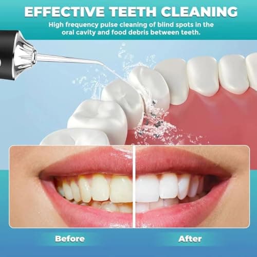 LSLCQW Water Dental Flosser Teeth Pick Portable Cordless Oral Irrigator Rechargeable Travel Irrigation Cleaner 3 Modes 4 Jets IPX7 Waterproof Electric (White) - Thumbnail 6