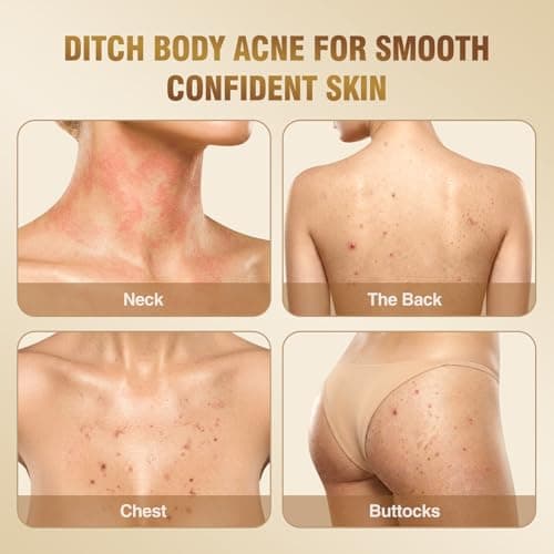 BIYSBER Salicylic Acid 2% Serum Solution for Face: Gently Exfoliating Facial Serum for Acne,Blackhead & Open Pores & Reduces Excess Oil - Hydrating& Soothing Skin Care Serum for Acne Prone&Oily Skin - Thumbnail 6