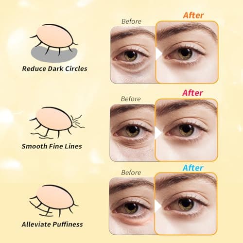 Under Eye Patches(36 Pairs), Valentines Day Gifts for Women, 24K Gold, Caffeine, Retinol Eye Masks for Puffy Eyes, Wrinkles, Dark Circles - Restoring & Awakening & Moisturizer - Thumbnail 4