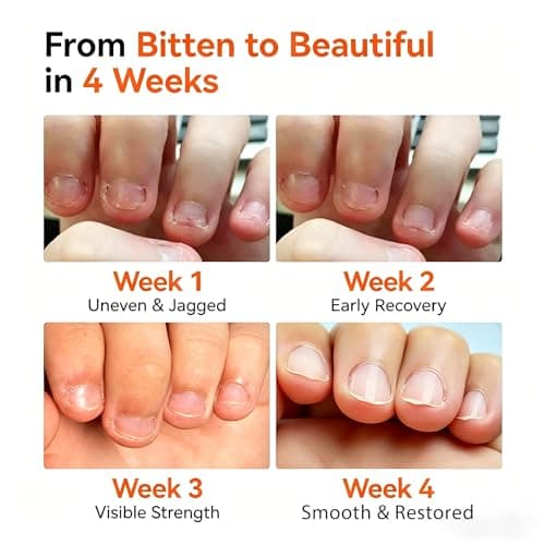 modelones Nail Biting Prevention for Kids Quick Dry Nail Biting Pen Thumb Sucking Deterrent Bitter No Bite Nail Polish for Nail Care Stop Biting Nails 0.48 fl oz - Thumbnail 2