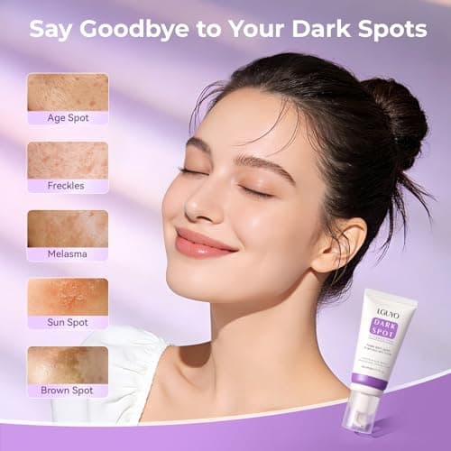 LGUYO Dark Spot Remover for Face & Body - Effective Remedy for Dark Spots & Dark Spot Corrector Cream for Age Spot, Freckles, Melasma, Sun Spot - Even Toning Skin Care for Women and Men - 1.7 Fl Oz - Thumbnail 2