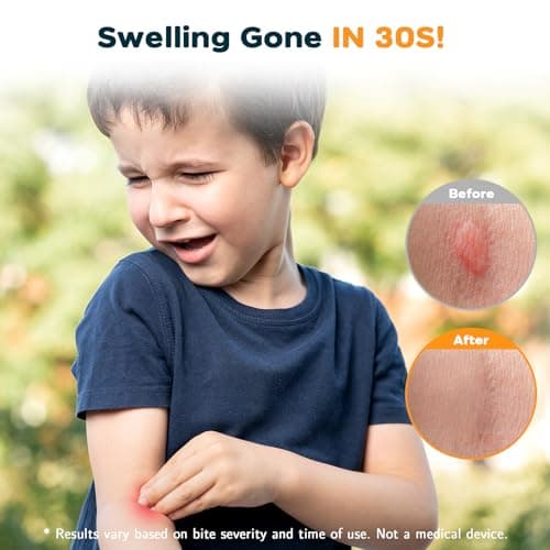 YARKOR Bug Bite Suction Tool 2 Packs, Natural Itch Relief & Swelling Sucker in 30s– Portable Bite & Sting First Aid – Venom Extractor for Hiking, Camping – Summer Essentials for Kids & Adults - Thumbnail 3