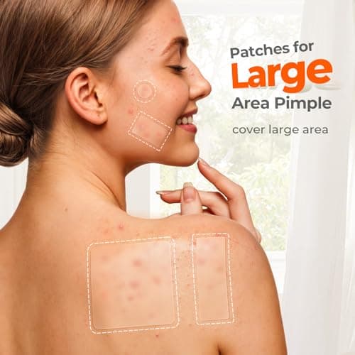 TKTK Large Pimple Patches for Face, 7 Sizes XL Acne Patches, Big Hydrocolloid Bandages for Body, Chin, Forehead, Chest, Back Zit Breakouts, Hydrocolloid Patch (Strip, Square, Dot 302 Count) - Thumbnail 3