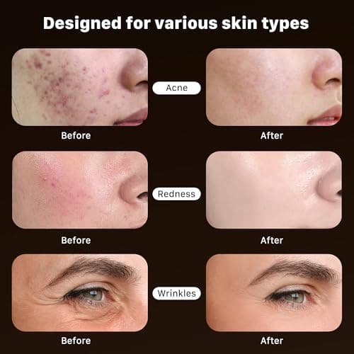 Red Light Therapy for Face, Near-infrared Led Face Mask Light Therapy with Remote, 3 Modes, 850nm Red Light Mask with Timing Function, Portable Led Light Therapy At Home 180 LED Beads - Thumbnail 3