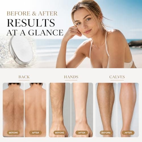 Aurorcness Crystal Hair Remover for Women Men, Hair Removal Device with 5th Nano Crystal Tech, Painless Exfoliation Epilators Reusable Epilator Device, Magic Hair Eraser for Whole Body Use - Thumbnail 4